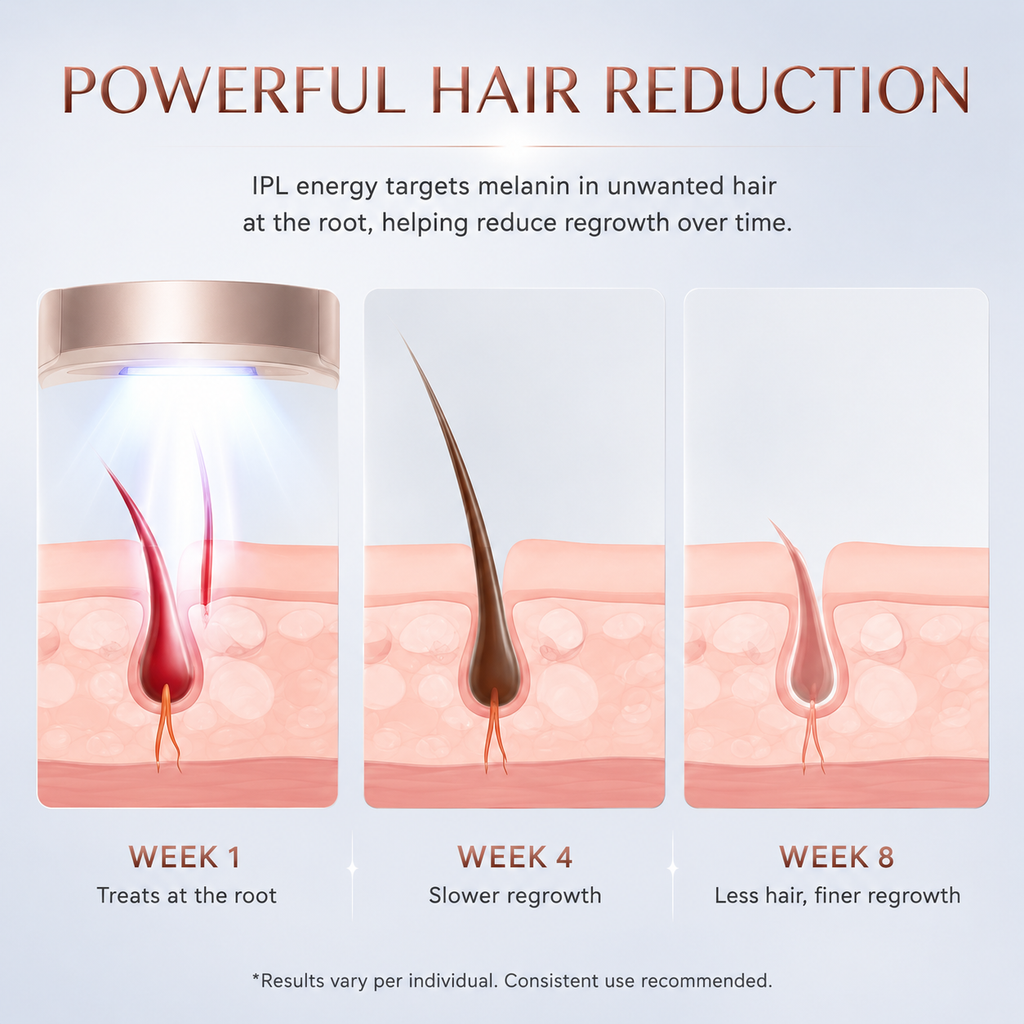 Body Silk IPL