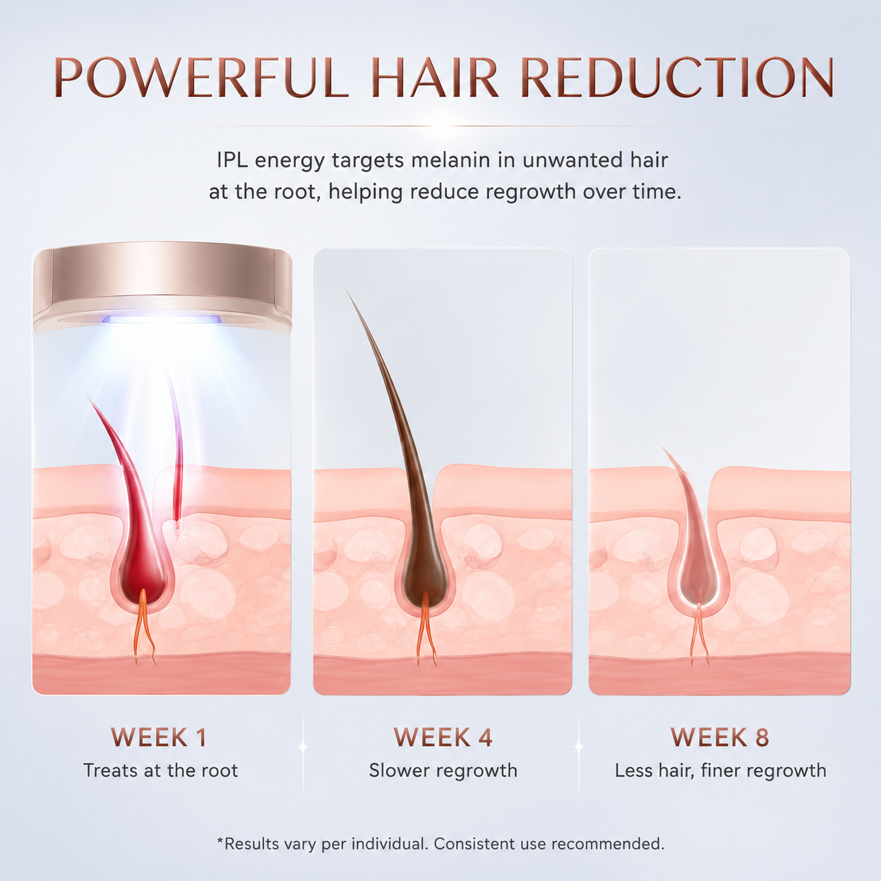 Body Silk IPL