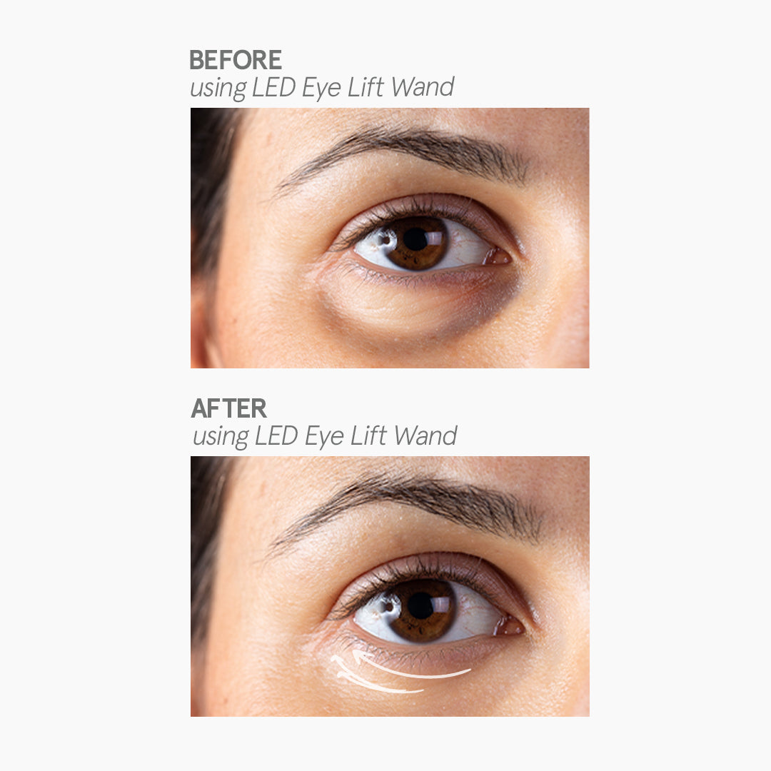 Love K-Derma LED Eye Lift Wand