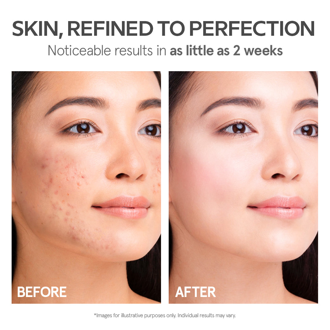 Love K-Derma Face & Body Routine Set
